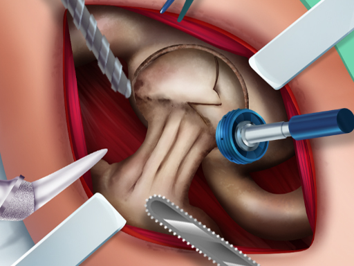 Operate Now! Pericardium Surgery 🕹️ Jogue no Jogos123